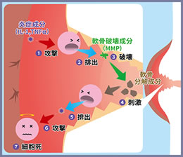 変形性膝関節症で起きている病的な炎症